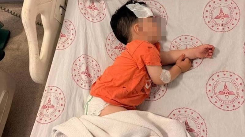 Halfeti’de 1 Buçuk Yaşındaki Çocuk Köpek Saldırısına Uğradı